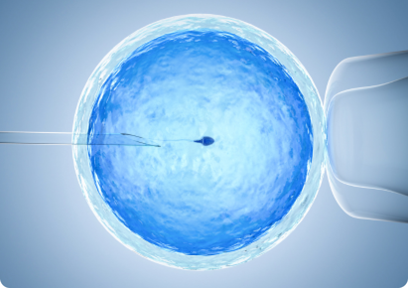 ICSI (Intracytoplasmic Sperm Injection)